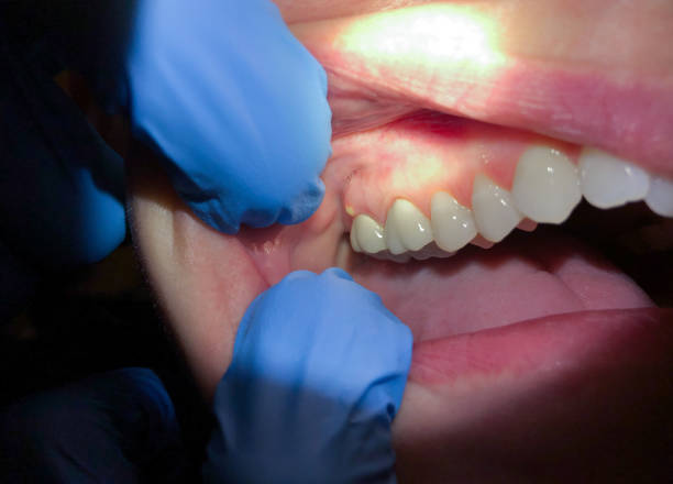 Best Walk-In Emergency Dentist in Newcastle, OK
